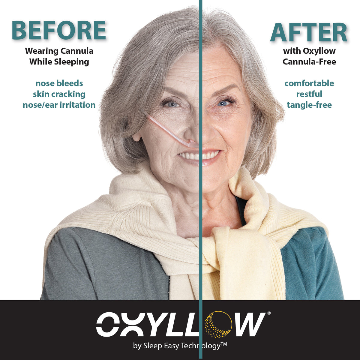 OXYLLOW NIGHT TIME SUPPLEMENTAL OXYGEN SYSTEM- IDEAL FOR SIDE SLEEPERS